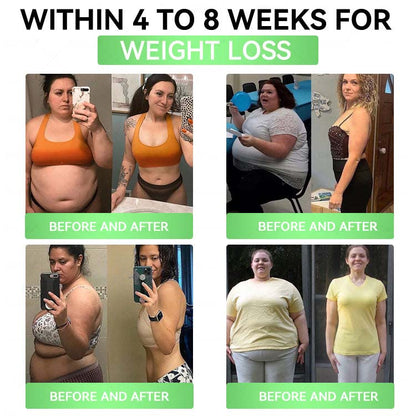 Official Store | Alcuras_Moringa × Berberine × AMPK 8-Benefit Slimming & Metabolic Nano Microneedle Patch 🇺🇸  Just once a day · Visible changes in 7 days  ✅ For obesity, loose skin, diabetes, sleep apnea, joint issues