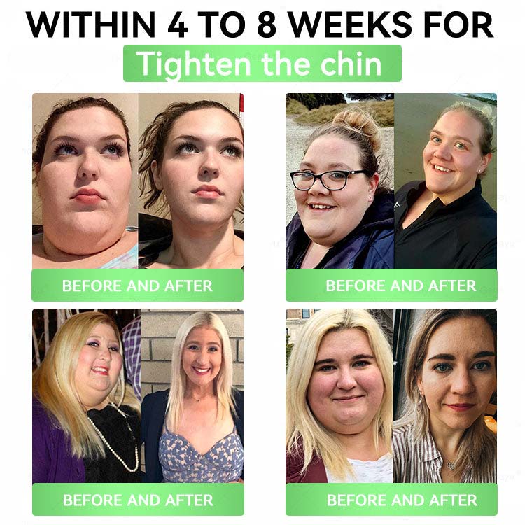 Official Store | Alcuras_Moringa × Berberine × AMPK 8-Benefit Slimming & Metabolic Nano Microneedle Patch 🇺🇸  Just once a day · Visible changes in 7 days  ✅ For obesity, loose skin, diabetes, sleep apnea, joint issues