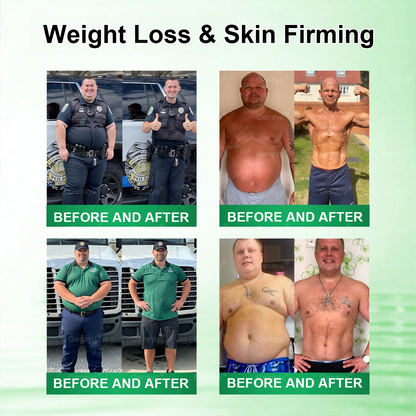 Official Store | Alcuras_Moringa × Berberine × AMPK 8-Benefit Slimming & Metabolic Nano Microneedle Patch 🇺🇸  Just once a day · Visible changes in 7 days  ✅ For obesity, loose skin, diabetes, sleep apnea, joint issues